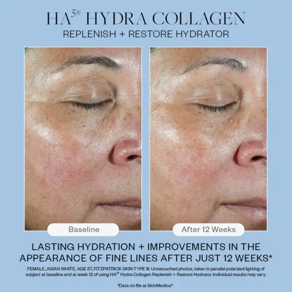 SkinMedica HA5 HYDRA COLLAGEN - Image 3