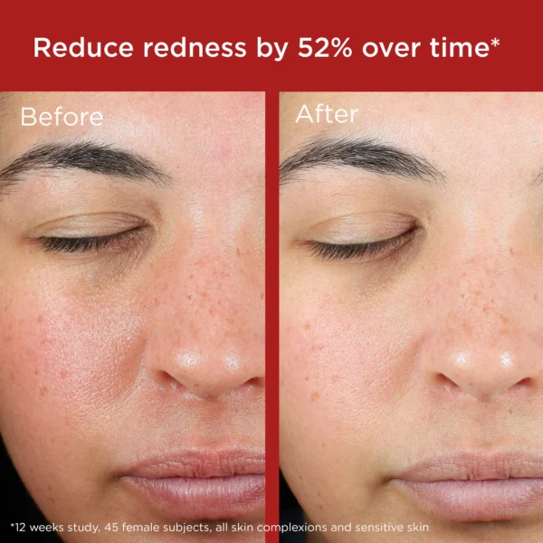 EltaMD UV Skin Recovery Broad Spectrum SPF 50 Face Sunscreen.  1.7 oz - Image 2